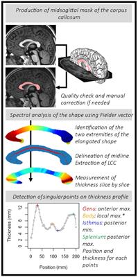 Spectral-based thickness profiling of the corpus callosum enhances anomaly detection in fetal alcohol spectrum disorders